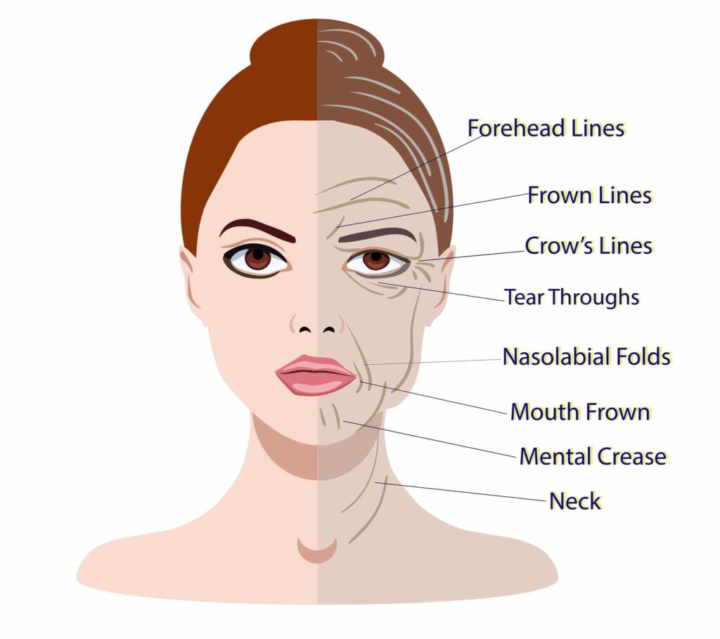 Types Of Lines On Face (Wrinkles) Glam Skin Review